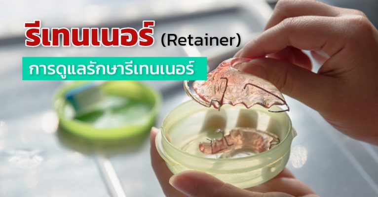 รีเทนเนอร์